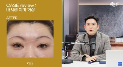 신논현 성형외과 바이브성형외과 LIVE 방송 출연 사진 5