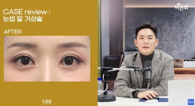 신논현 성형외과 바이브성형외과 LIVE 방송 출연 사진 7