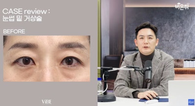 신논현 성형외과 바이브성형외과 LIVE 방송 출연 사진 6