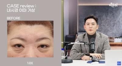 신논현 성형외과 바이브성형외과 LIVE 방송 출연 사진 4