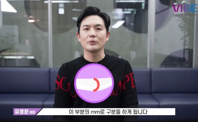 江南站鼻部手术假体高度，如何选择？(VIBE整形外科的建议) 사진 6
