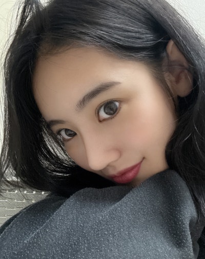 自然美的答案，论岘无假体隆鼻手术 VIBE整形外科 ｜VIBE PICK 无假体隆鼻手术案例💜 사진 6