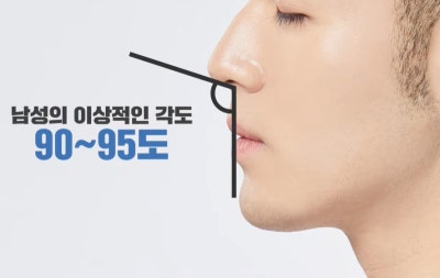 남자코수술 고민된다면?｜강남코수술 바이브성형외과에서 말하는 핵심✨ 사진 6