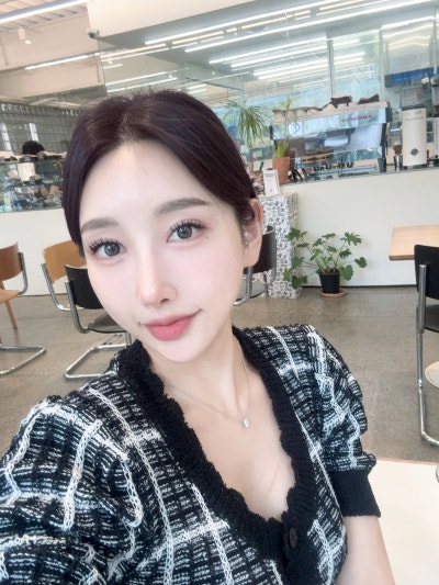 다시 선명해진 눈매와 첫 코성형의 조화,강남 코성형 바이브성형외과｜VIBE PICK 눈재수술·첫 코성형 케이스💜 사진 7
