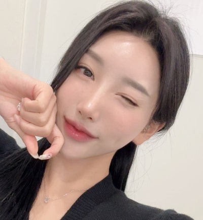 다시 선명해진 눈매와 첫 코성형의 조화,강남 코성형 바이브성형외과｜VIBE PICK 눈재수술·첫 코성형 케이스💜 사진 8
