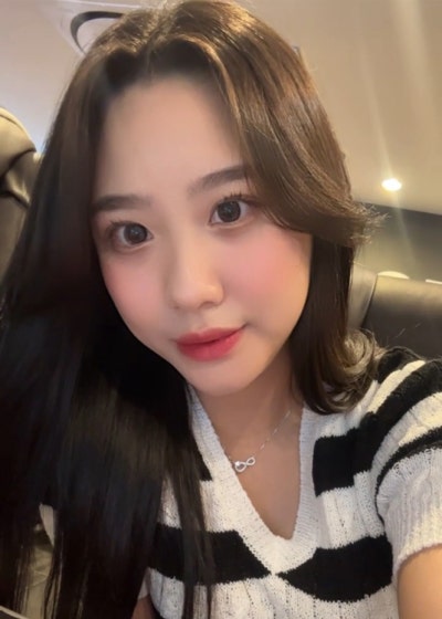 Natural Nose Line Achieved with First Rhinoplasty | VIBE PICK Hooked Nose & Bulbous Nose Correction at Sinnonhyeon VIBE 