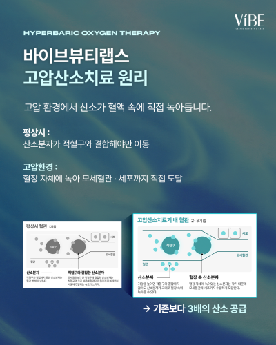✨고압산소치료, 수술 후 회복 관리의 새로운 선택지|바이브성형외과에서 경험해보세요 사진 3