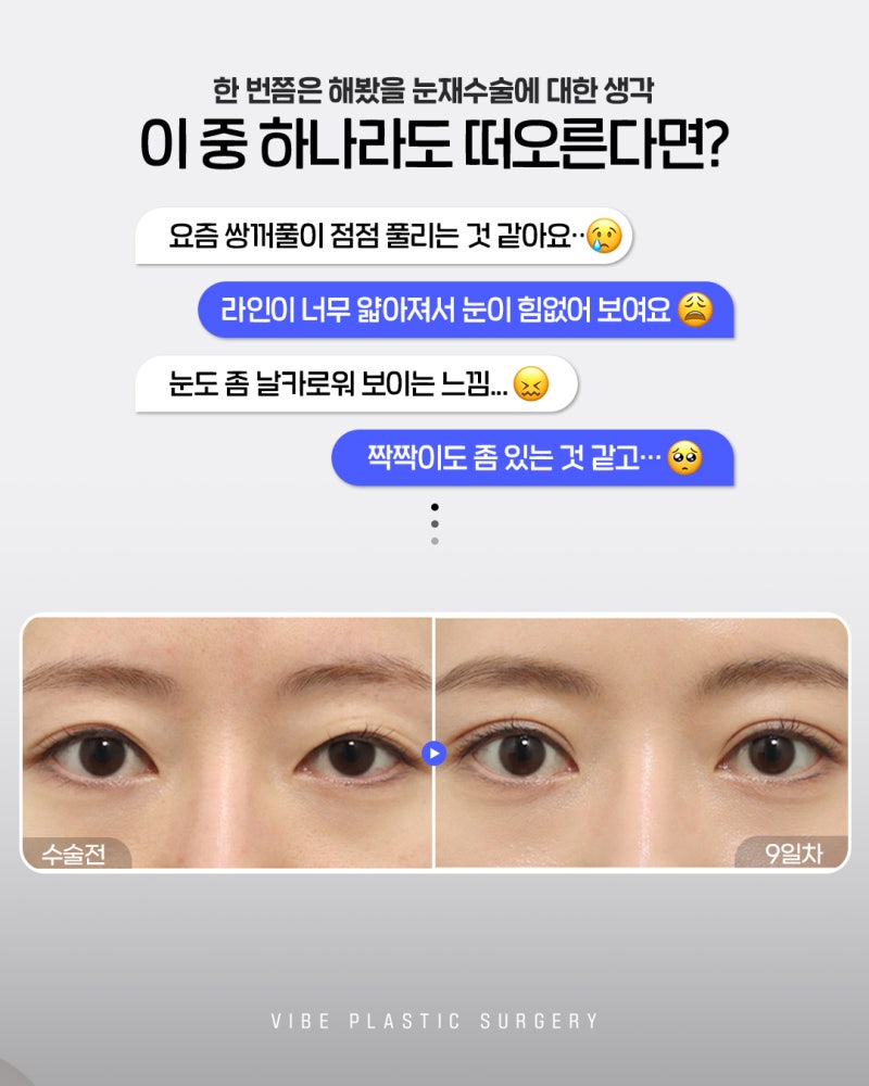 눈재수술 고민 끝! 신논현역성형외과 바이브성형외과 선택 이유 사진 2