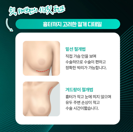 복숭아 가슴성형, 체형까지 고려한 맞춤 가슴성형|신논현 바이브성형외과에서 만나보세요