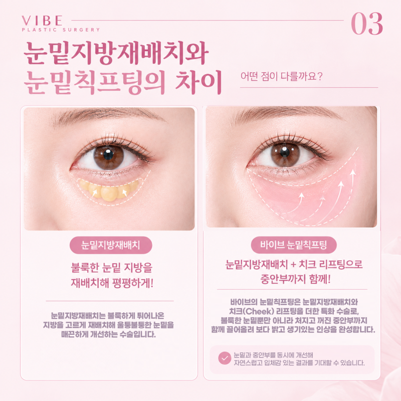 눈 밑만 밝혀도 인상이 달라진다? 강남 성형외과 바이브성형외과 시그니처 눈밑칙프팅 사진 5