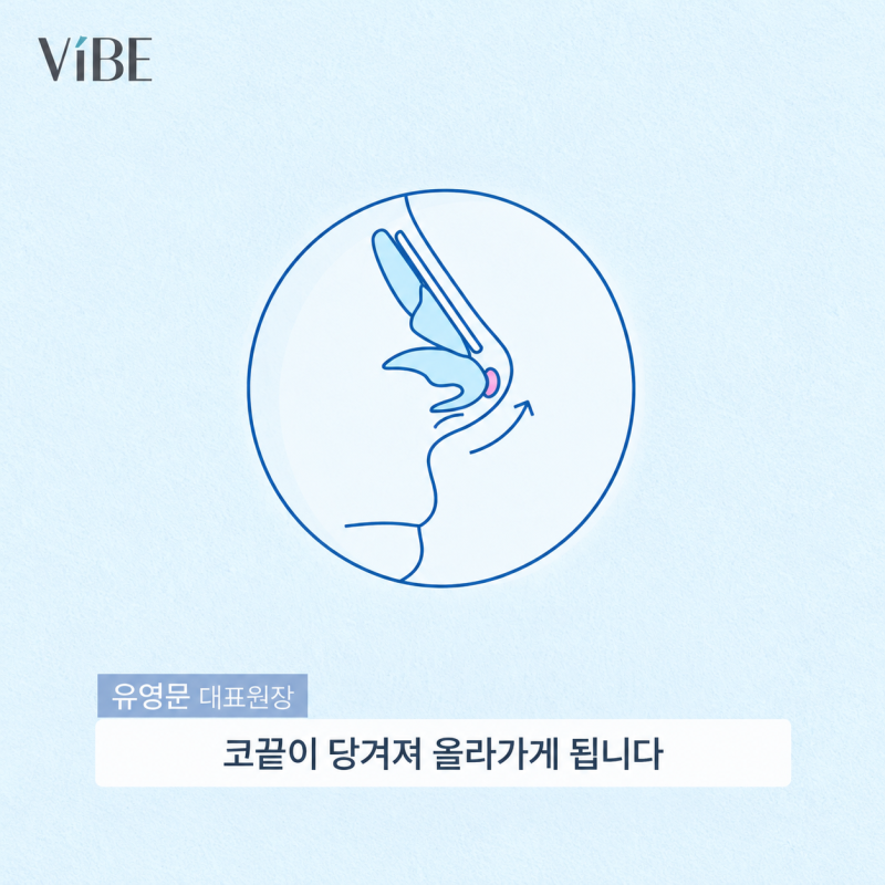 코성형 부작용 해결법(구축/ 염증/ 휜코) 강남 코재수술 바이브성형외과 사진 3